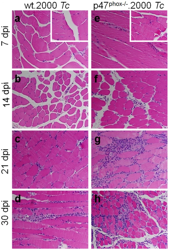 Histological analysis of inflammatory infiltrate in <i>T. cruzi</i>-infected p47<sup>phox−/−</sup> mice.