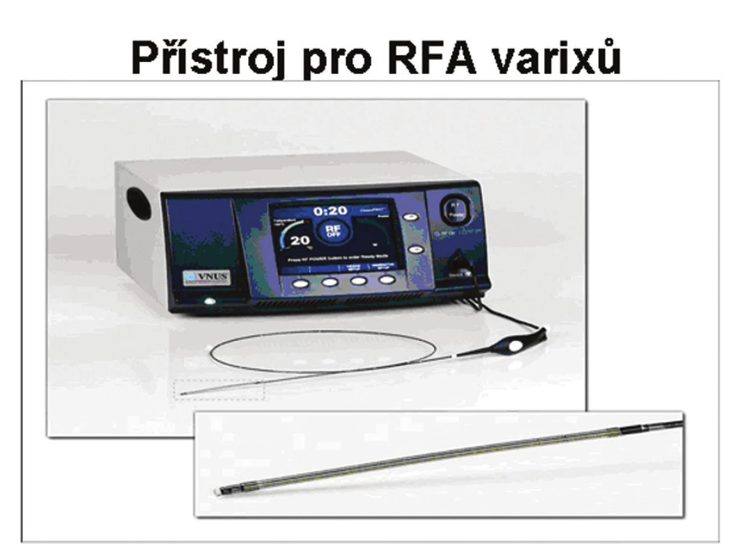 Přístroj pro RFA varixů
Fig. 1. RFA apparatus