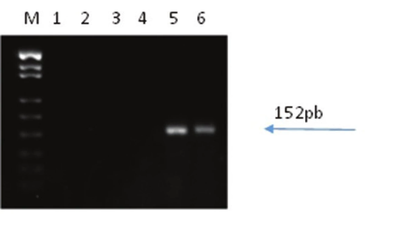 Reverzní transkripce a PCR s primery a próbami pro amplifikaci mRNA LT antigenu MCPyV: