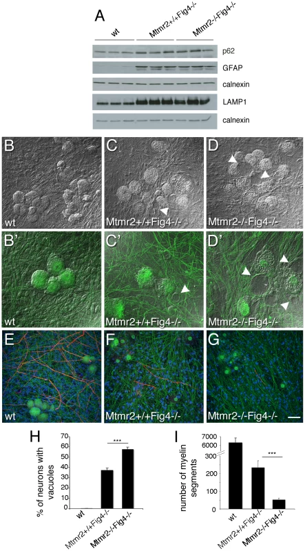 Mtmr2 loss in neurons exacerbates <i>Fig4</i>-null neurodegeneration.