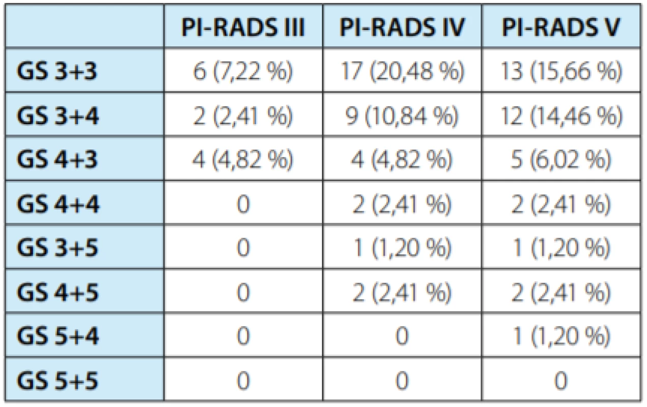 Tabulka porovnávající počty případů PI-RADS
score versus Gleason score u 83 pacientů, kde byla
cílená biopsie pozitivní<br>
Tab. 3. Table comparing the numbers of detected cases
of PI-RADS score versus Gleason score in 83 patients where
the targeted biopsy was positive