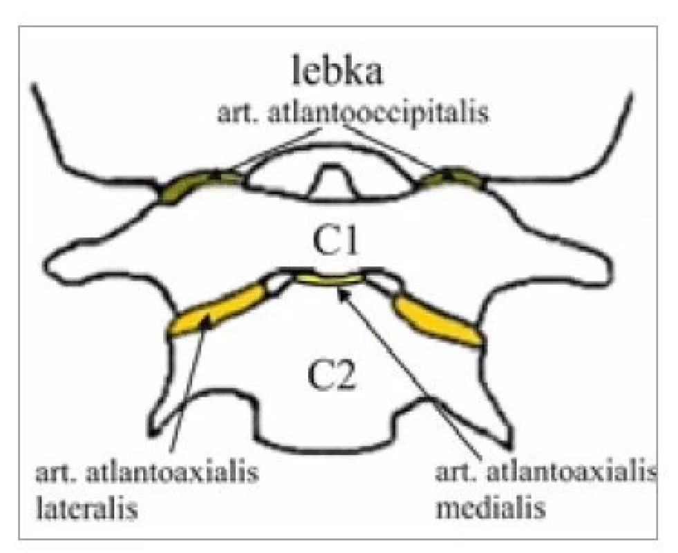 Suboccipitálne väzy a membrány
(zdroj: autori).<br>
Fig. 3. Suboccipital ligaments and
membranes (source: authors).