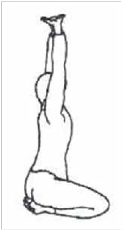 Cvik pre meridián žalúdka<br>
Fig. 6. Exercise for the stomach
meridian