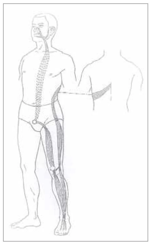 Šľachovo-svalová dráha žalúdka<br>
Fig. 5. Tendon-muscle path of the stomach