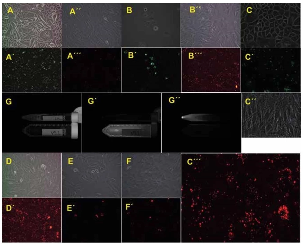 Primary oral keratinocytes and mesenchymal stem cells on the cultivation plastic or in cell suspension just before
transplantation<br>
Phase contrast or fluorescence microscopy of primary oral keratinocytes from pig L139 (A or A´, 100x magnification), L531 (B or B´,
100x magnification) and T61 (C or C´, 200x magnification). Phase contrast or fluorescence microscopy of mesenchymal stem cells
from pig L139 (A´´ or A´´´, 100x magnification), L531 (B´´ or B´´´, 100x magnification), T61 (C´´ or C´´´, 200x magnification), T79 (D or
D´, 100x magnification), T67 (E or E´, 100x magnification) and T83 (F or F´, 100x magnification). Primary cell suspensions of animal
T61 prior to transplantation: bright field of MSCs and pOKs in both falcons (G), Cy3 fluorescence of mesenchymal stem cells in 50ml
falcon (G´), FITC fluorescence of labelled primary oral keratinocytes in 15ml falcon (G´´), images acquisition by the ChemiDoc™
XRS+ System.