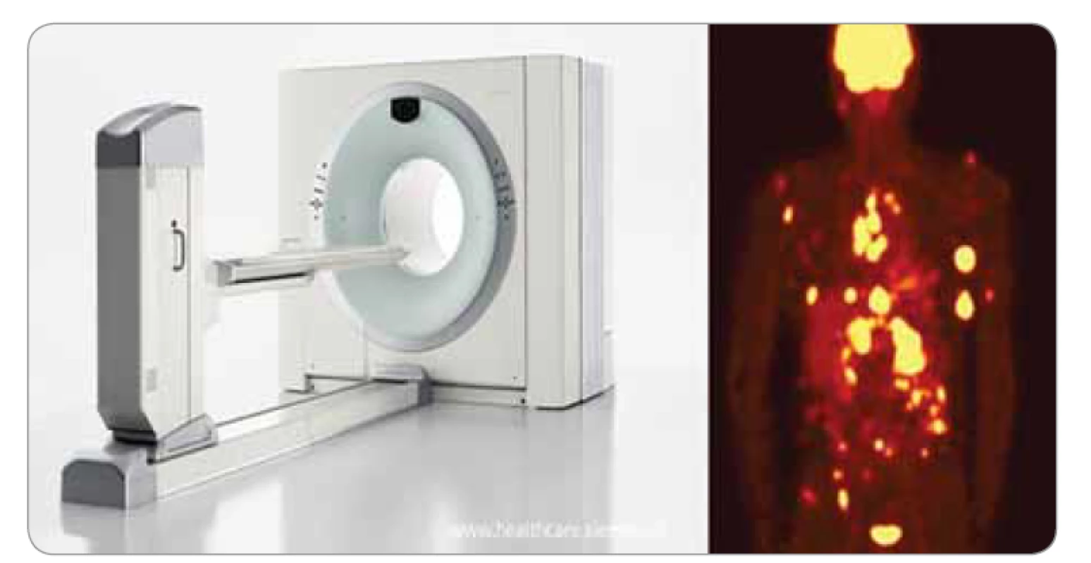 Pozitronová emisní tomografie/výpočetní tomografie.