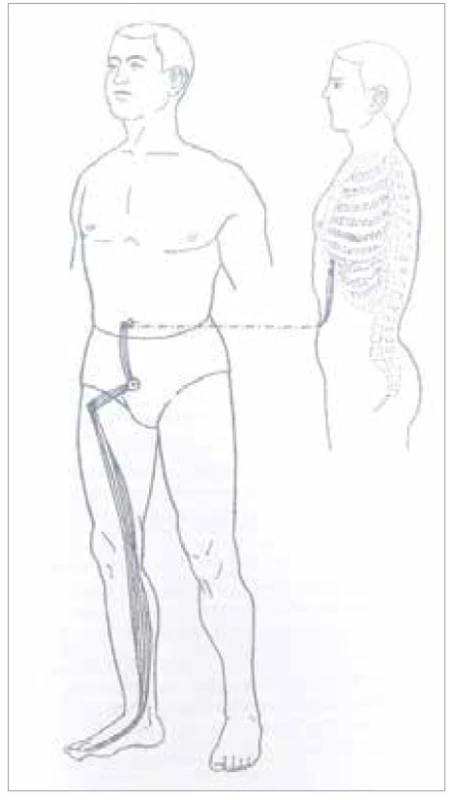Šľachovo-svalová dráha
sleziny<br>
Fig. 7. Tendon-muscle path of the
spleen