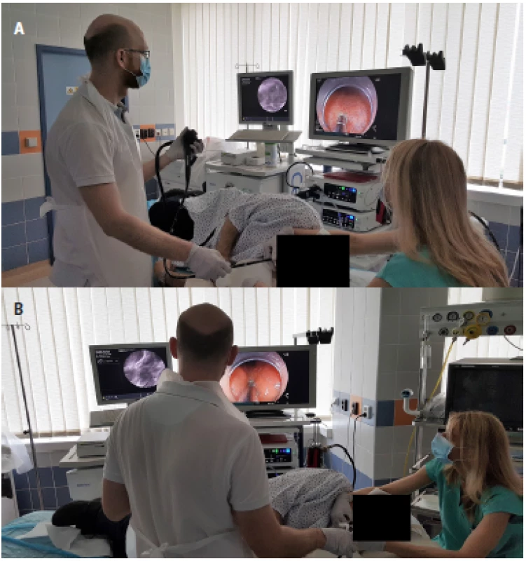Position of the endoscopic tower Fujifilm® and the Cellvisio endoscopy system® including the laser scanning unit and display (Mauna Kea Technologies, Paris, France) during the endoscopic procedure