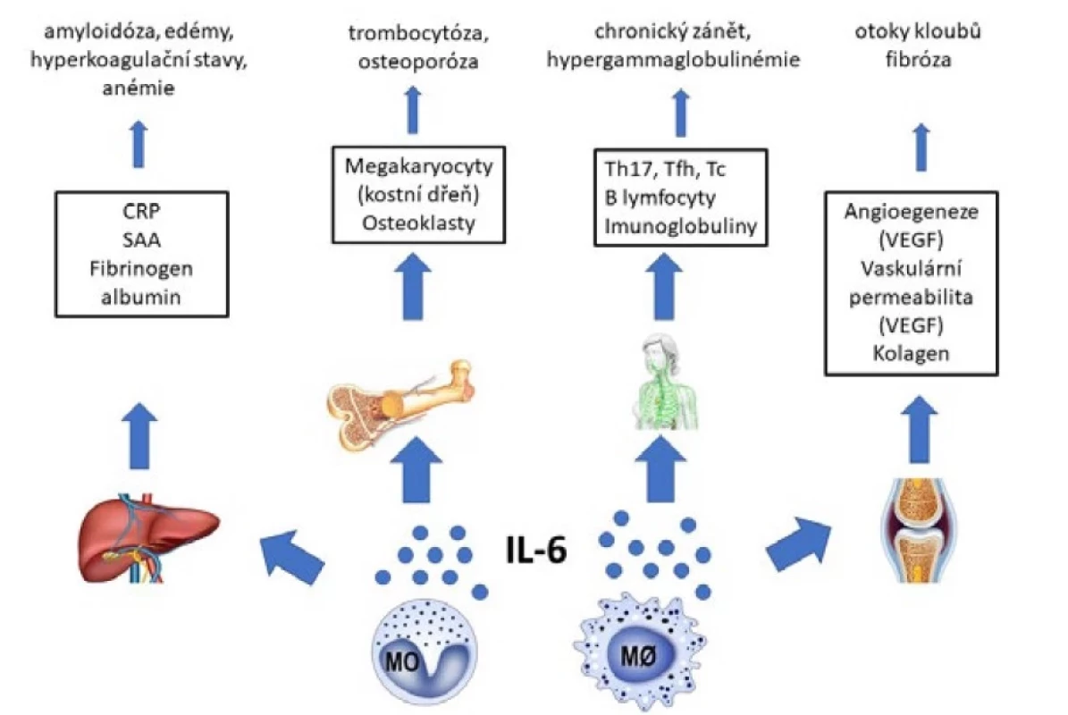 Účinky interleukinu 6 (IL-6) a jejich vztah k projevům multicentrické formy Castlemanovy choroby (11, 12)
