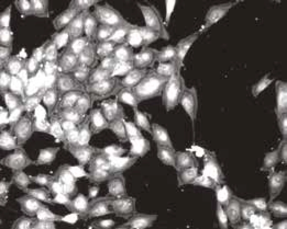 Buňky MG63 na povrchu
vzorku obarvené
fluoresceinem, jedno
hodnocené obrazové pole<br>
Fig. 4
The MG63 cells,
colored by fluorescein,
on the surface of the sample,
one of the analyzed fields
