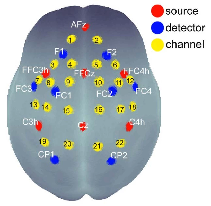 Scheme of the distribution of detectors, sources and channels above the cortical regions of the brain with respect to the EEG 10-20 system. 22 channels cover from the frontal cortex to the parietal cortex.