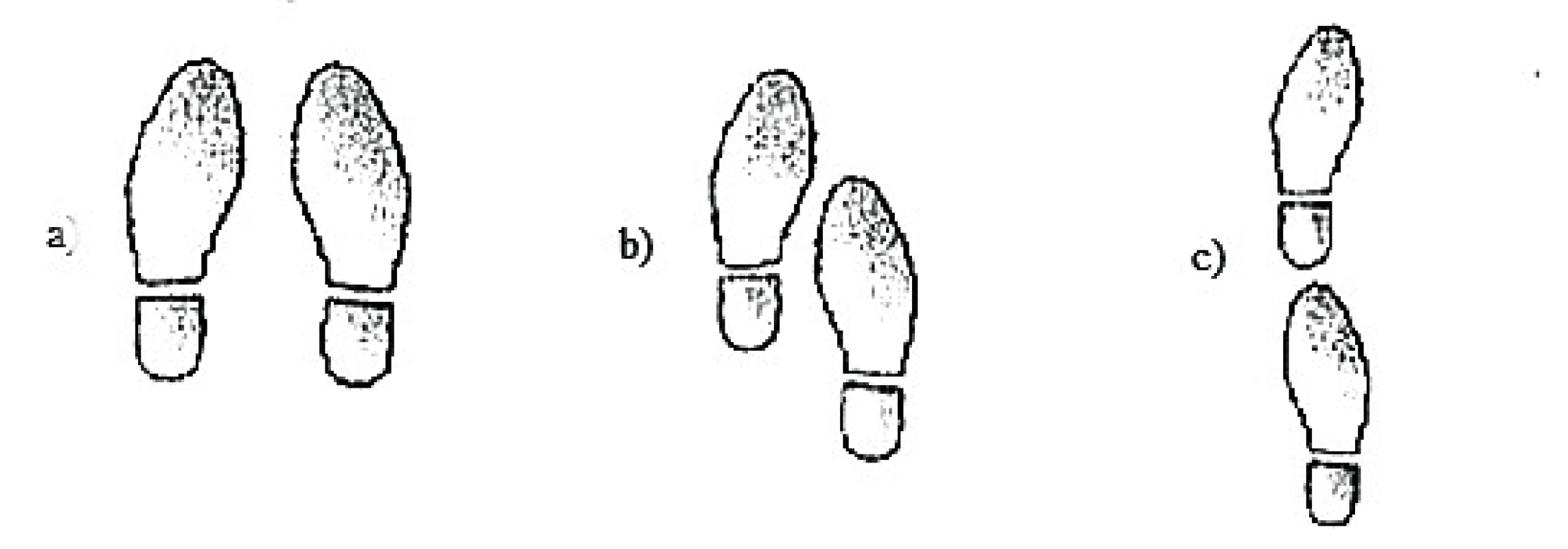 Test rovnováhy a) stoj spojný b) semitamdemová pozícia a c) tamdemová pozícia v stoji (Lippertová-Grünerová, 2005).