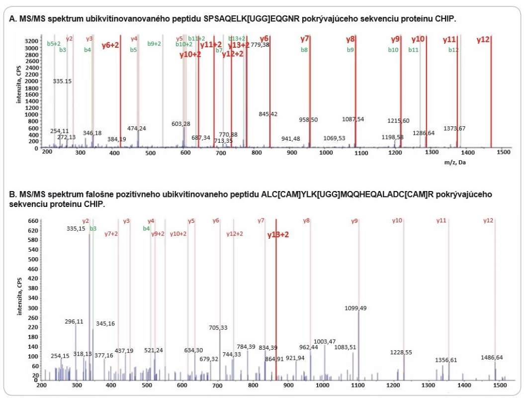 Fragmentačné spektrum peptidu SPSAQELK[UGG]EQGNR (A) a fragmentačné spektrum peptidu ALC[CAM]YLK[UGG]MQQHEQALADC[
CAM]R (B) so zvýraznenými produktovými iónami potvrdzujúcimi prítomnosť GlyGly modifi kácie na lyzíne. Fragmentačné
spektrum A naznačuje, že Lys8 nesie GlyGly zbytok ubikvitínu. V produktových iónoch y6–y12 dochádza k charakteristickému posunu
m/z o +114 Da (GlyGly zbytok). Rovnaký posun m/z možno sledovať aj v b sérii produktových iónov (b8–b12) indikujúci prítomnosť
GlyGly zbytku ubikvitínu. Fragmentačné spektrum B obsahuje len jeden produktový ión potvrdzujúci modifi káciu GlyGly.
Ubikvitinácia peptidu ALC[CAM]YLK[UGG]MQQHEQALADC[CAM]R nebola potvrdená, keďže jediný charakteristický produktový ión
s posunom +114 Da môže pochádzať z iného kofragmentovaného prekurzorového iónu.