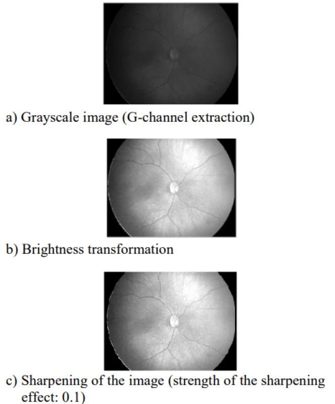 First part of preprocessing image: a) image in
grayscale, b) brightness transformation, c) sharpening
of the image with parameter strength of the sharpening
effect 0.1.