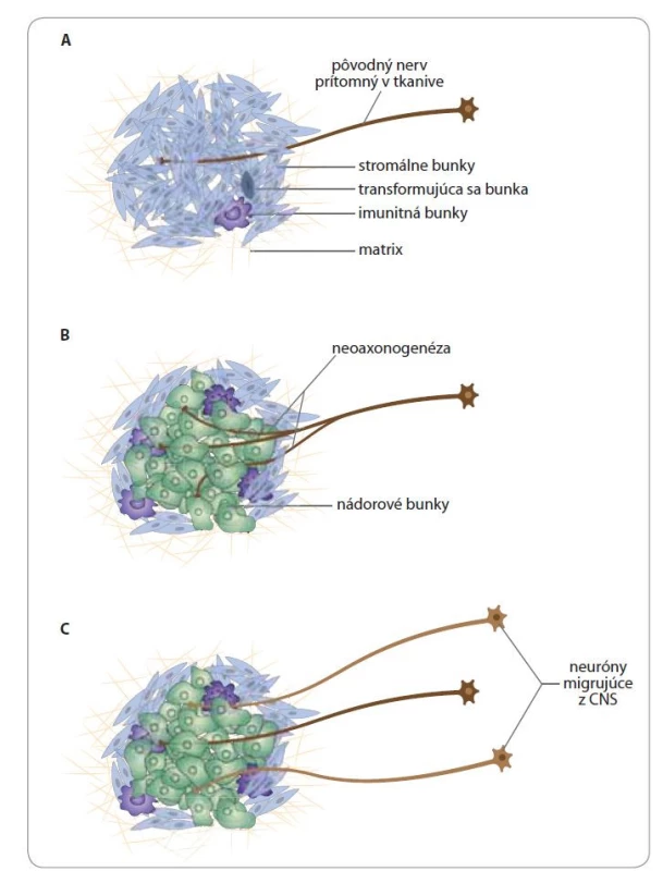 Schematické znázornenie zdrojov inervácie nádorového tkaniva.