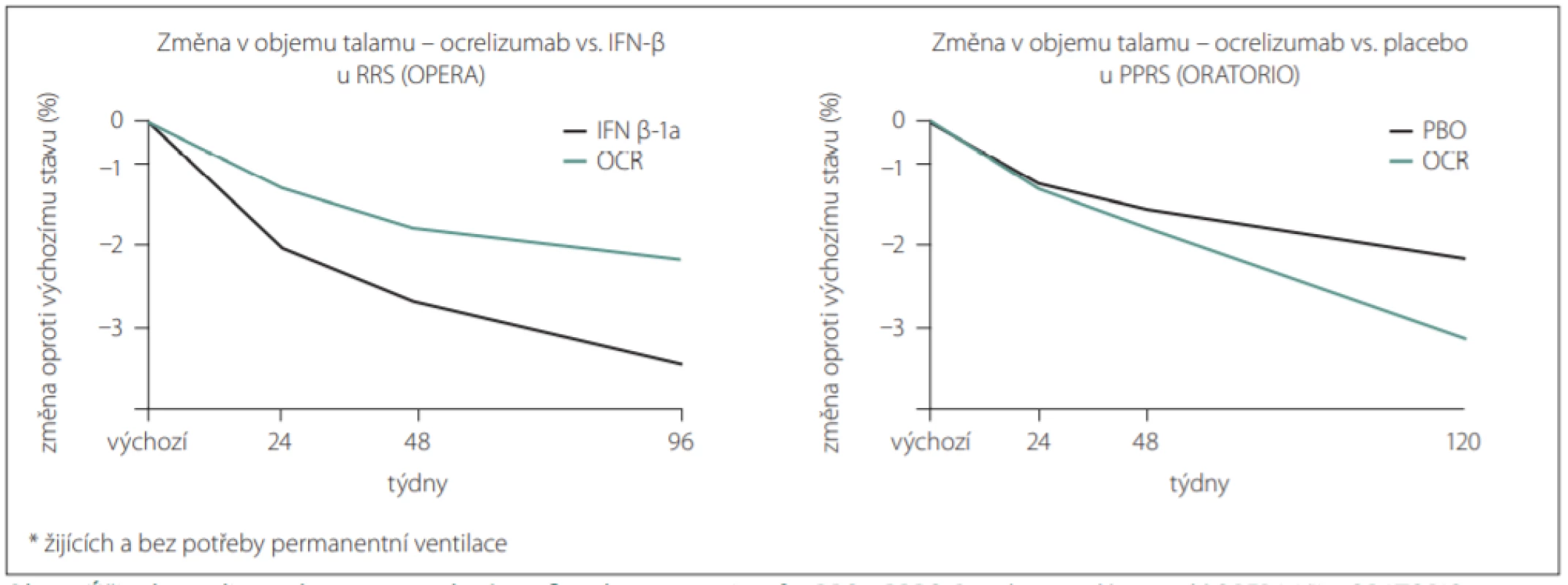 Účinek ocrelizumabu na zpomalení atrofi e talamu u pacientů s RRS a PPRS. <br>
Fig. 1. Ocrelizumab eff ect on slowdown of thalamic atrophy in patients with RMS and PPMS.