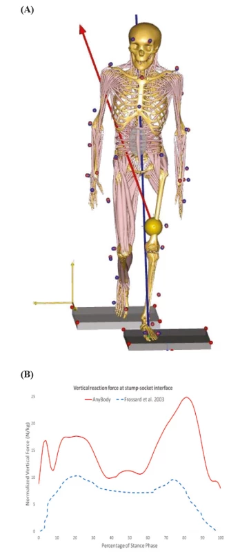 (A) AnyBody™ simulation during stance
phase for simulated amputee gait. (B) Bodyweight
normalized vertical reaction forces at the stump–socket interface. Solid line: current study; dashed line from [32].