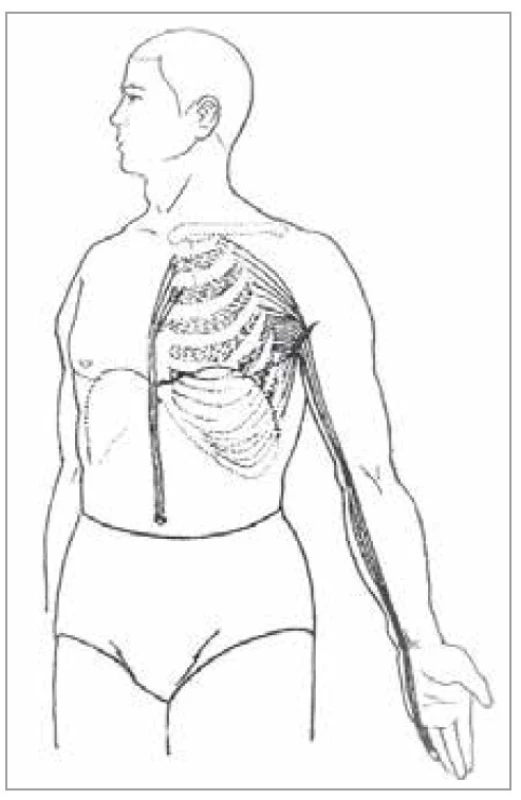 Šľachovo-svalová dráha srdca<br>
Fig. 9. Tendon-muscle path of the heart