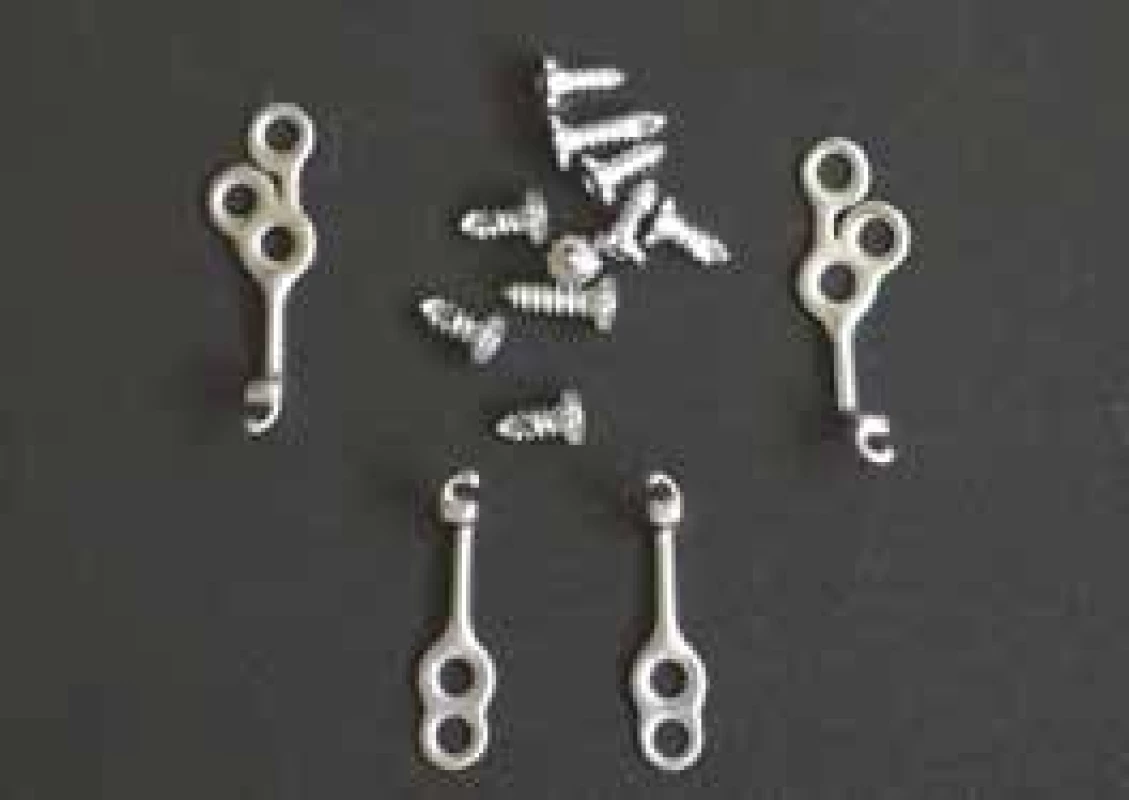 Skeletální miniplaty typu
Bollard s fixačními šrouby
– sada určená pro jednoho
pacienta<br>
Fig. 1
Bone anchored
Bollard miniplate with screws
– one pacient set