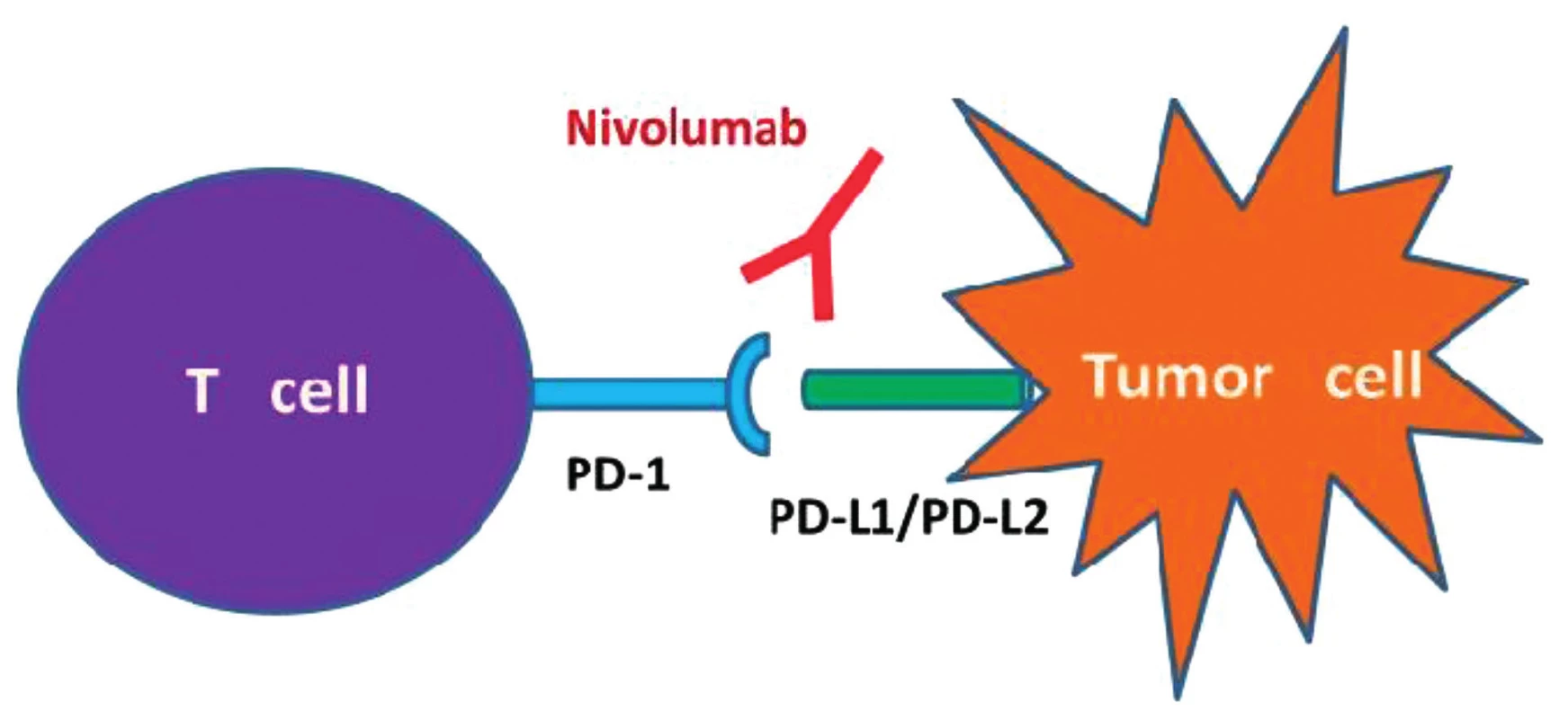 Immune checkpoint 2 Nivolumab, „check-point“ inhibitor PD-1,mechanismus působení CPI
Nivolumab je humánní monoklonální protilátka IgG4 fungující jako inhibitor „check point“ PD-1
(„programmed death“). Aktivuje protinádorovou imunitní odpověď T lymfocytů. Zabraňuje vazbě PD-1
na jeho ligandy PD-L1 a PD-L2 a tím blokuje přenos inhibičního signálu do T-lymfocytu.
IgG4 – imunoglobulin G4.<br>
(Upraveno podle Postow MA, Callahan MK, Wolchok JD, Blockade in cancer therapy. J Clin Oncol
2015;33(17):1974–1982).