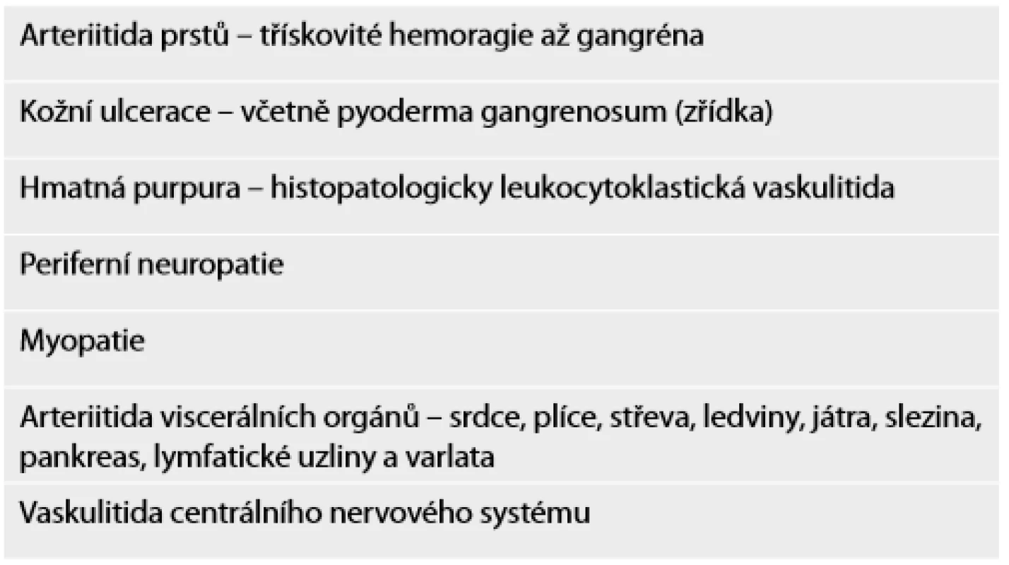 Klinické projevy revmatoidní vaskulitidy.

