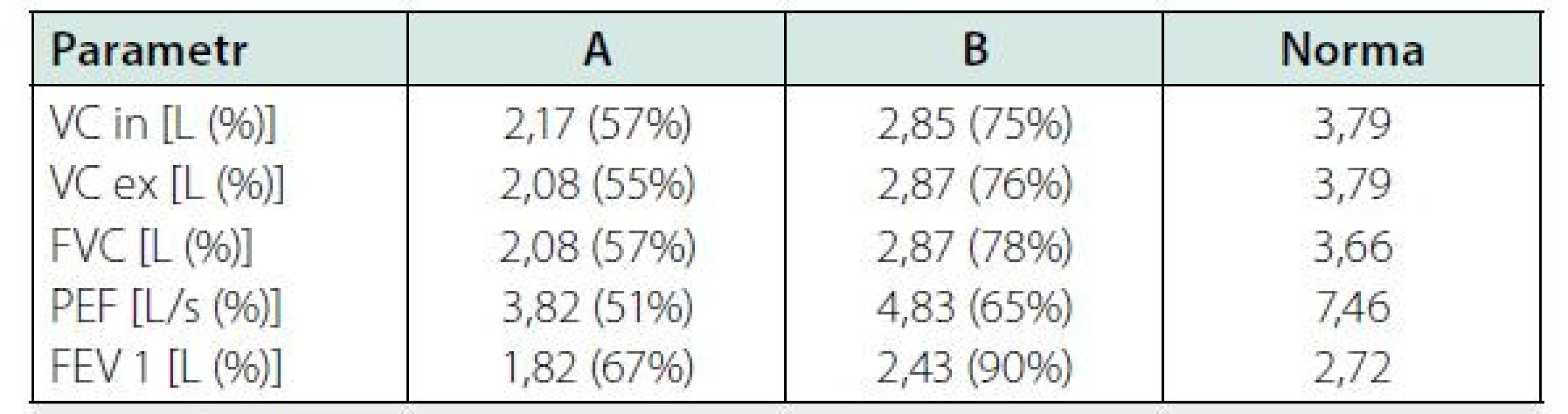 Srovnání vybraných parametrů spirometrie při terapii amiodaronem
(sloupec A) a 3 měsíce po jeho vysazení se současnou terapií kortikoidy
(sloupec B)