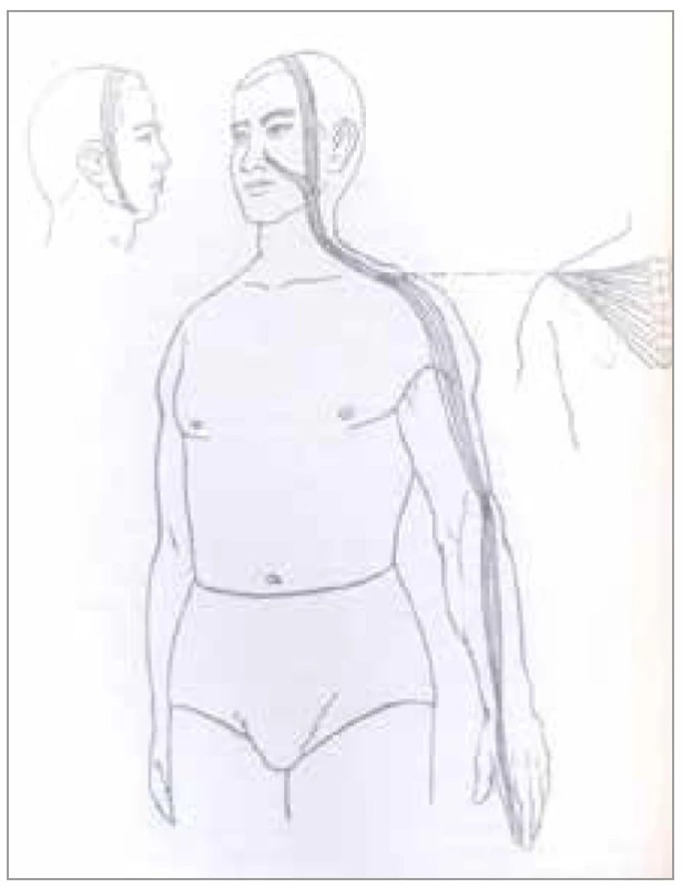 Šľachovo-svalová dráha hrubého čreva<br>
Fig. 3. Tendon-muscle path of the colon