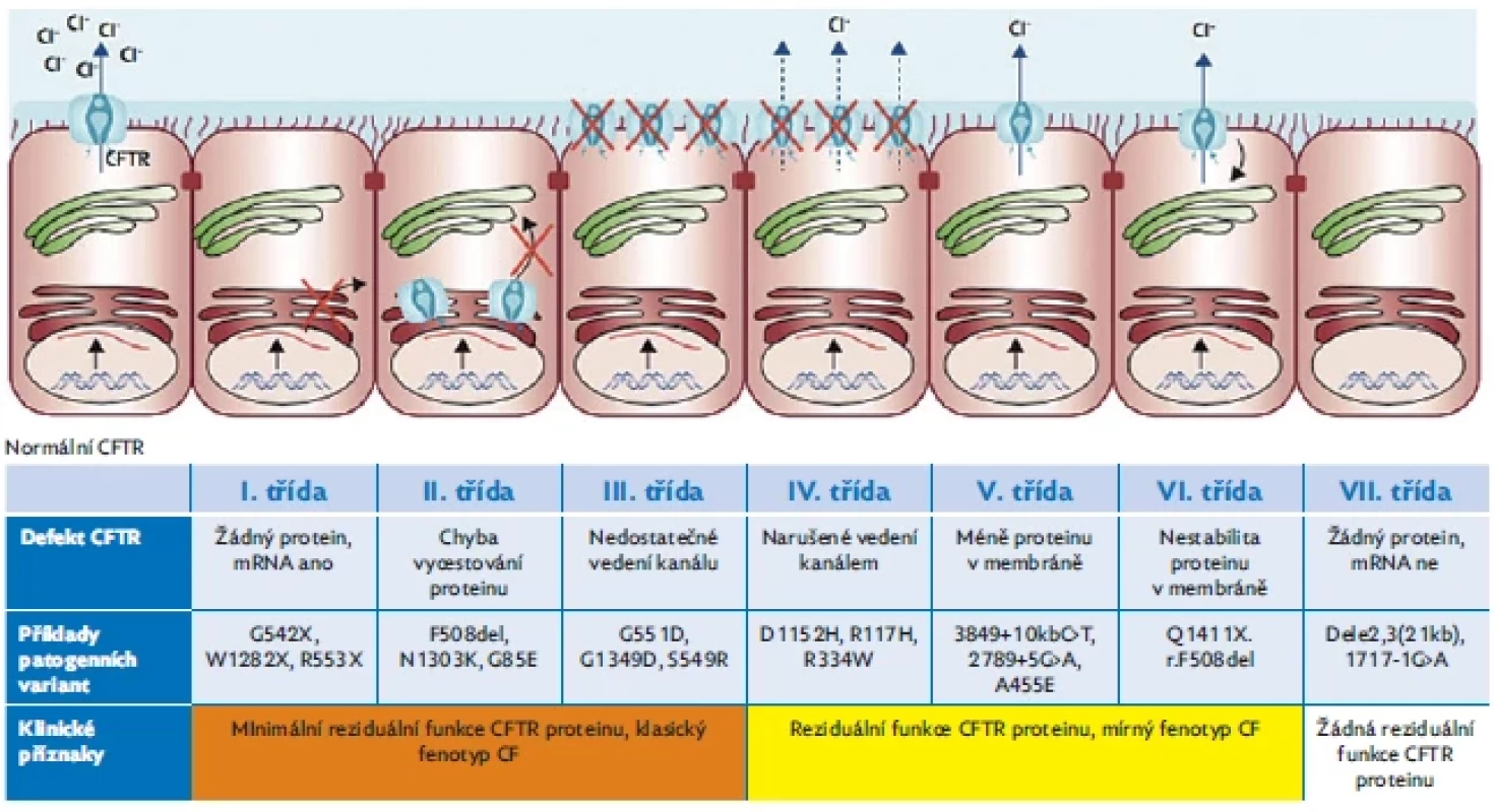 Funkční klasifikace patogenních variant genu CFTR. Podle funkčního defektu CFTR proteinu řadíme varianty CFTR genu do 7 funkčních
tříd. Varianty I.–III. a VII. třídy charakterizuje absence nebo těžce narušená tvorba či funkce CFTR proteinu a jsou spojeny s jeho nulovou
nebo minimální funkcí. Varianty IV.–VI. třídy jsou méně závažné, spojené s variabilní mírou reziduální funkce CFTR. Byly navrženy specifické
terapie podle mechanismu vzniku funkčního defektu CFTR proteinu s předpokladem, že jedna léčivá molekula může být účinná na všechny
varianty uvnitř stejné funkční třídy. Upraveno dle De Boeck & Amaral (2016).(5)