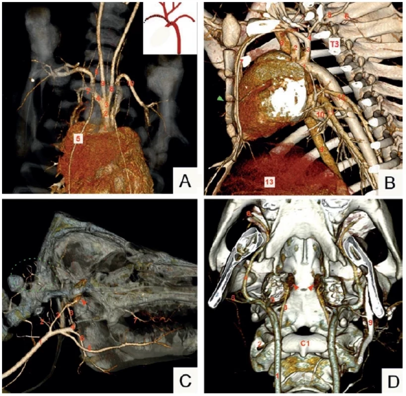 CT angiografie prasete domácího, plemeno Přeštické černostrakaté, volume rendering technique (VRT); hrudník
zpředu (A), v boční projekci, pohled zleva (B); hlava, pohled zprava (C), basis cranii externa (D) <br> 
Fig. 1. CT angiography, domestic pig, Prestice Black Pied breed, VRT; thorax, anterior view (A); left lateral view (B); head,
right lateral view (C), external cranial base (D)