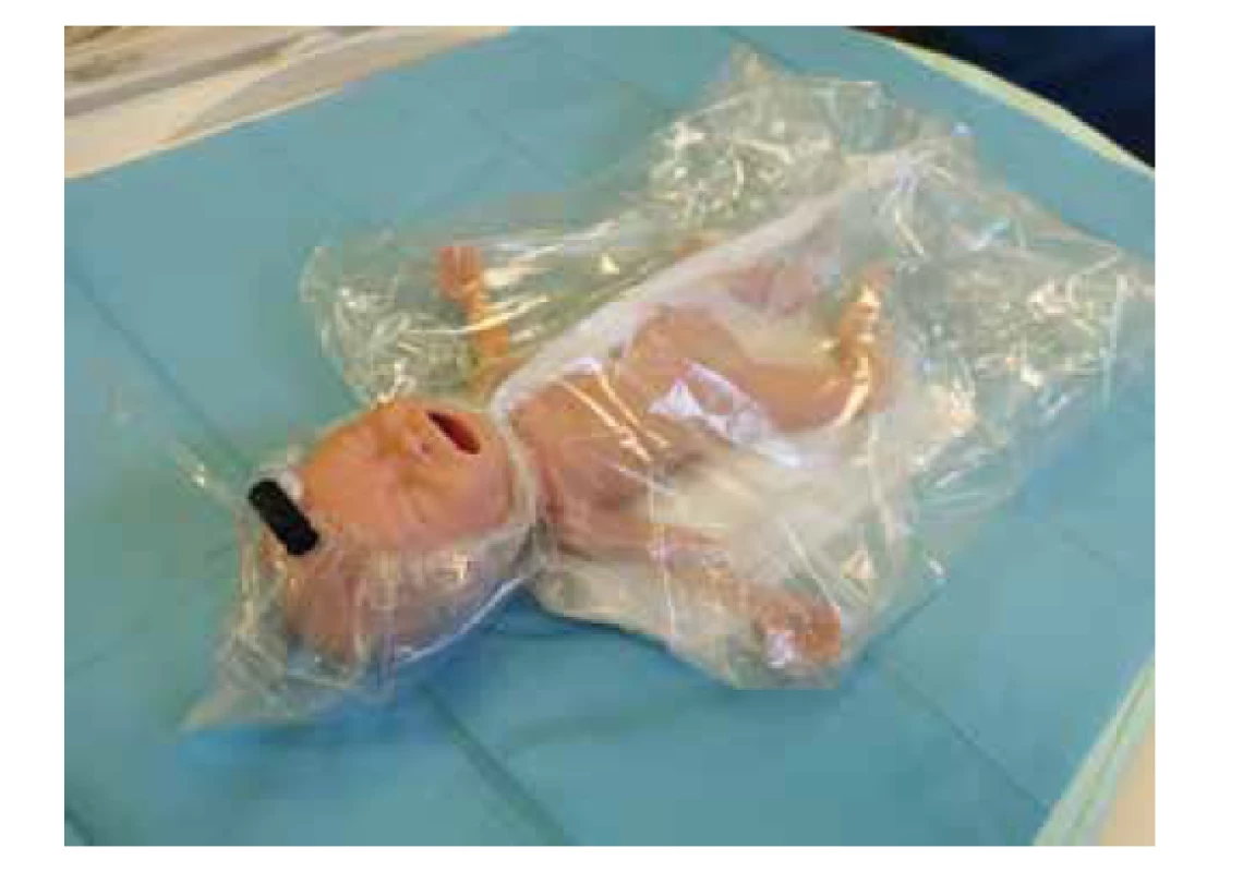 Krytí nedonošených polyetylenovým obalem.<br>
Fig. 2. Cover preterm infants with polyethylene wrap.