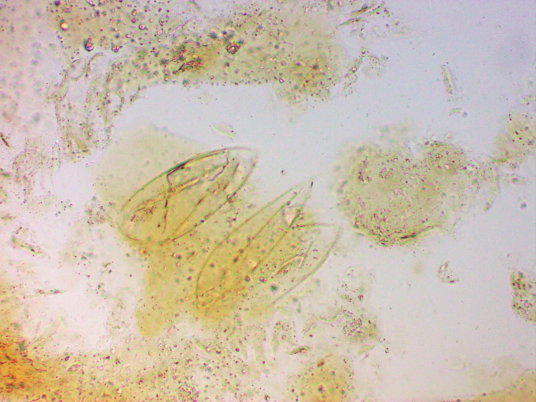 Prázdná vajíčka Sarcoptes scabiei z odebraných šupin, světelný mikroskop, 10% KOH, zvětšeno 200x.<br>
Fig. 4. Sarcoptes scabiei empty ova, sample from skin scales, light microscopy, 10% KOH mount, magnification 200x.