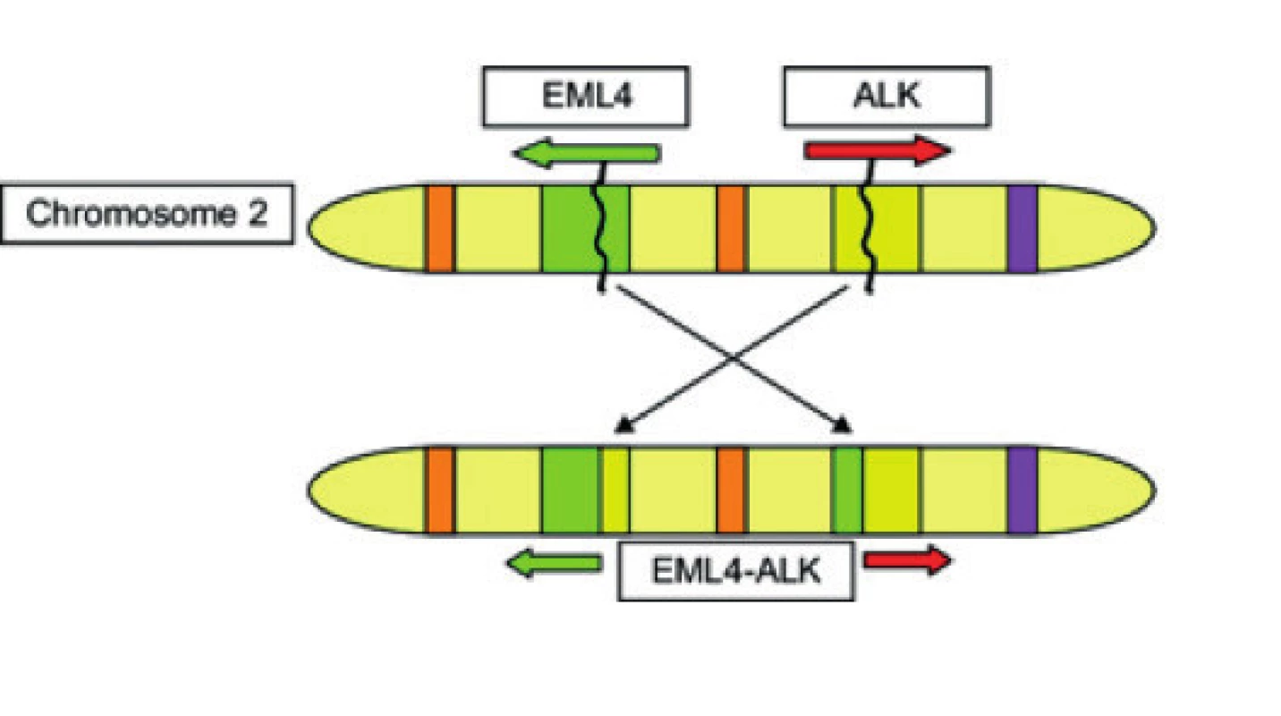 Vznik fúzního genu EML4/ALK (12) <br>
EML – echinoderm microtubule associated protein-like 4, ALK – Anaplastic Lymphoma Receptor Tyrosine Kinase
