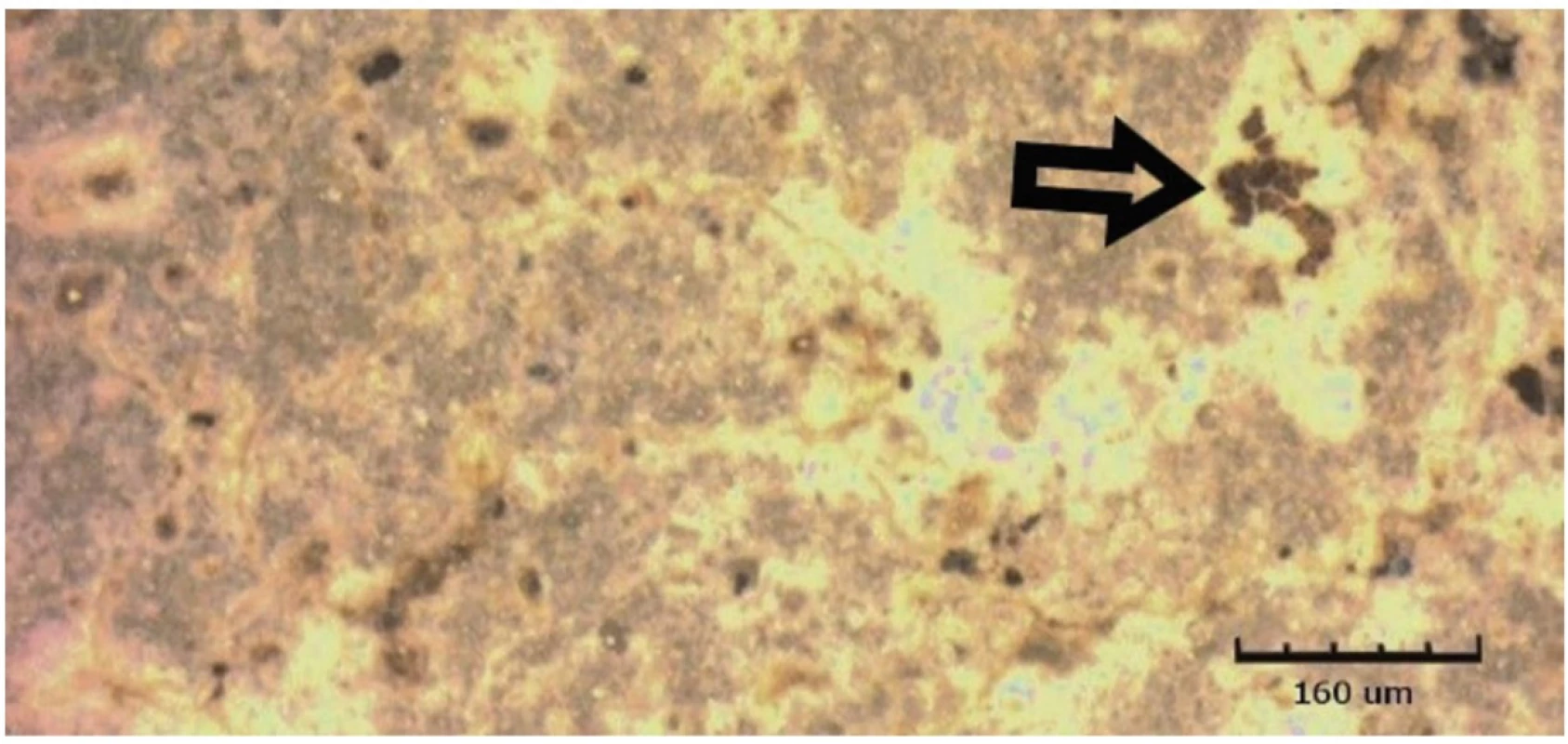 Omnifill C vystavený kyselému pH po dobu 14 dnů, zobrazeno CLSM<br>
Fig. 8 Omnifill C exposed to acidic pH for 14 days, shown by CLSM