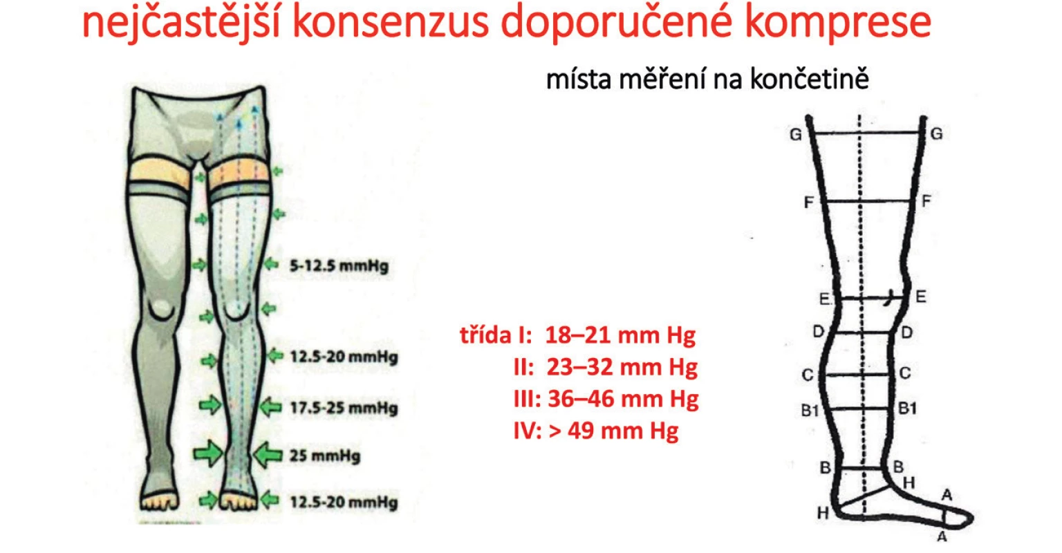 Kompresní tlaky dle standardu NSR (8) a místa měření obvodů na končetině
