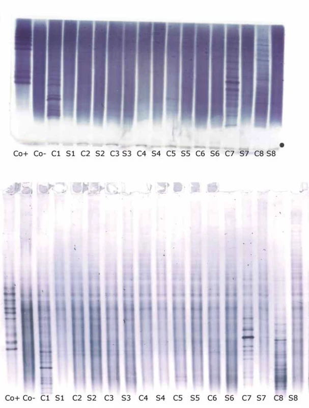 Oligoclonal IgG on agarose IEF/immunofixation (top) and PAG IEF/immunoblotting (bottom). Anode is at the top. No qualitative discrepances (negative versus positive) between the two methods were noted in these samples.
C1–8 – paired cerebrospinal fluid samples; Co+ – positive control (CSF Control, Sebia, Evry Cedex, France); Co– – negative control (intravenous IgG remedy Flebogamma®, Instituto Grifols, Barcelona, Spain); IEF – isoelectric focusing; IgG – immunoglobulin G; PAG – polyacrylamide gel; S1–8 – paired serum samples