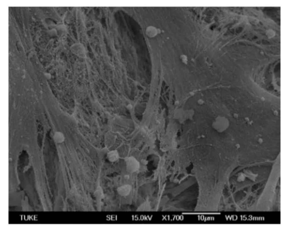 The surfaces of bovine bone tissue with attached
hMSCs