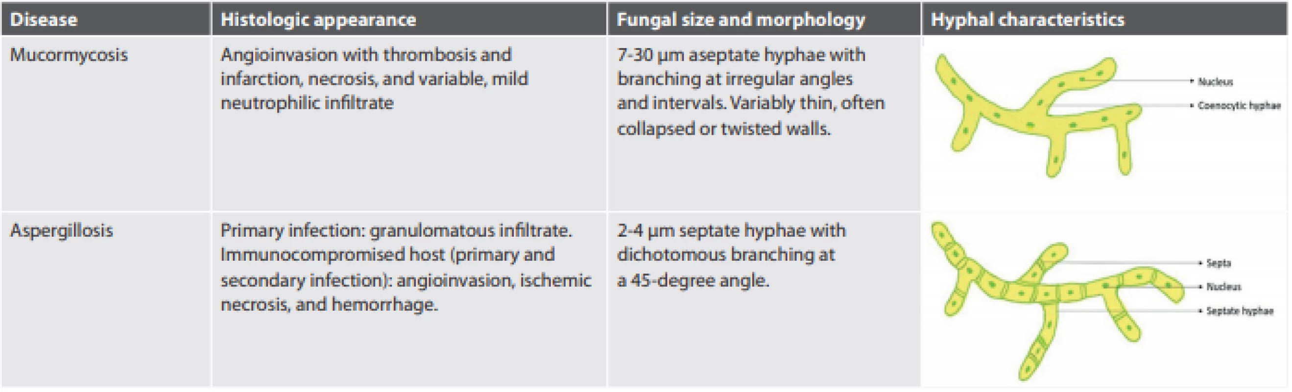 Characteristics of Mucormycosis versus Aspergillosis.