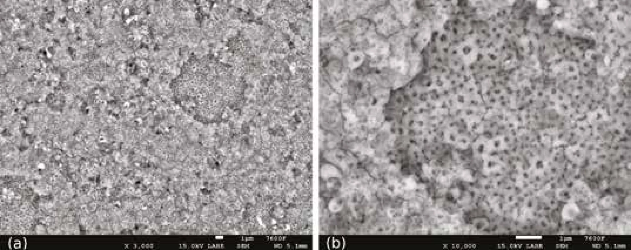 Anodizovaný povrch vzorků
z Ti6Al4V ELI, přehled (a)
a detail (b)<br>
Fig. 1
Surface of anodized
Ti6Al4V ELI samples, overview (a)
and detail (b)