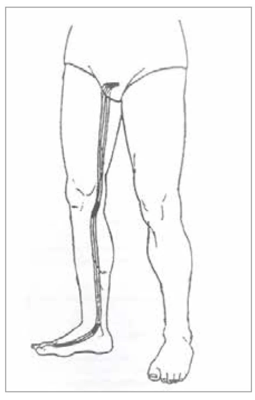 Šľachovo-svalová dráha
pečene<br>
Fig. 23. Tendon-muscle pathway of the
liver