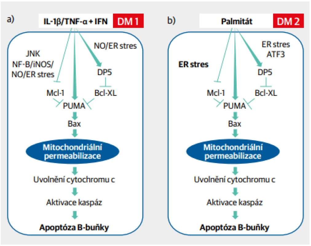 Jednotící model patogeneze diabetu 1. a 2. typu na úrovni B-buňky. Aktivace B-buňky cytokiny a dalšími
faktory zánětlivé reakce (diabetes 1. typu) nebo mastnými kyselinami (diabetes 2. typu) vede k nitrobuněčnému oxidačnímu stresu přes aktivaci endoplazmatického retikula, k poškození mitochondrií, aktivaci kaspáz
a následné apoptóze B-buňky
