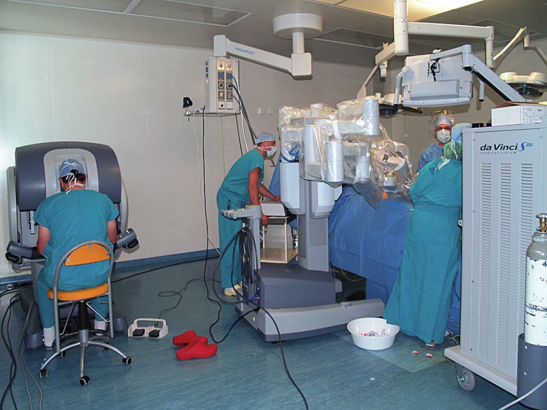 Systém daVinci S. Pohled na pracujícího operatéra,
který je zcela mimo operační pole