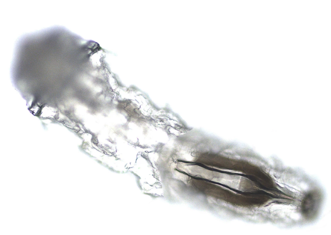 Larva Oestrus ovis z ventrálního pohledu (zvětšení
100x) s detailem vnitřních orgánů