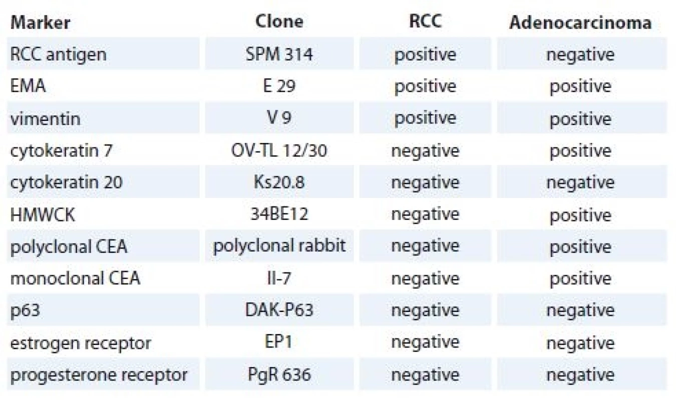 List of antibodies and results of immunostaining in both tumor components.