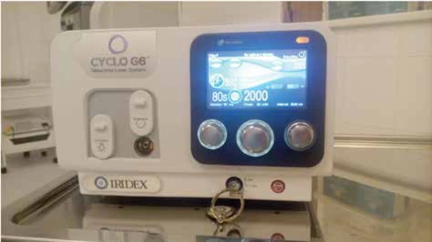 Laser Cyclo G6 firmy Iridex. Na monitoru přístroje je vidět nastavení
parametrů: délka aplikace 80 sekund, energie 2000 mW