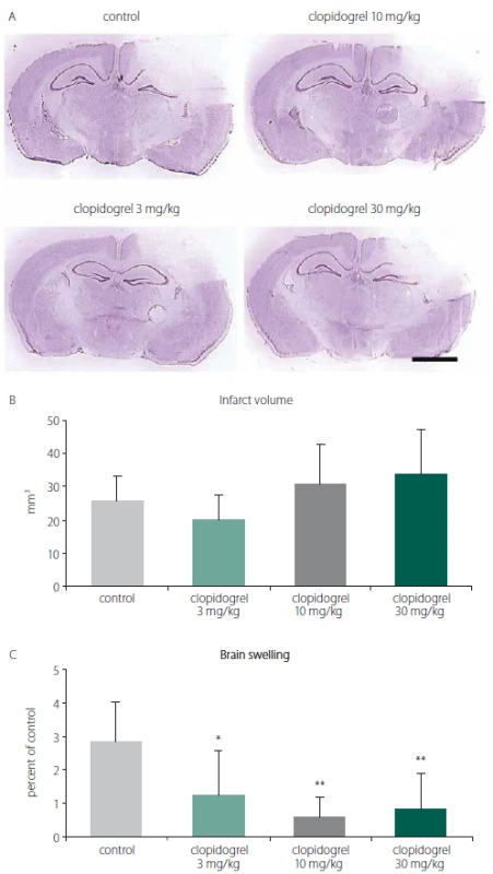 A) Cresyl violet (Nissl staining) staining
is commonly used to identify the neuronal
structure in the brain. It is performed
24 h after the brain injury. (B) Infarct volume
and (C) brain swelling. 24 h after brain injury,
clopidogrel treatments did not change
infarct volume development signifi cantly.
However, treatments of 3 and particularly
10 or 30 mg/kg clopidogrel decreased brain
swelling significantly. The values are given
as mean ± SD. Distance bar = 2 mm.
*P < 0.05; **P < 0.01 compared with vehicletreated control group<br>
Obr. 1. (A) Barvení kresolovou violetí (barvení
Nissl) se běžně používá k identifi kaci
neuronální struktury v mozku. Provádí se za
24 h po poranění mozku. (B) Objem infarktu
a (C) otok mozku. 24 h po poranění mozku
léčba klopidogrelem nezměnila signifikantně rozvoj objemu infarktu. Avšak 3, ale
zejména 10 a 30 mg/kg aplikovaného klopidogrelu
signifi kantně snížilo otok mozku.
Hodnoty jsou uvedeny jako průměr ± SD.
Distanční lišta = 2 mm.
*p < 0,05; **p < 0,01 v porovnání s kontrolní
skupinou, které bylo podáváno vehikulum