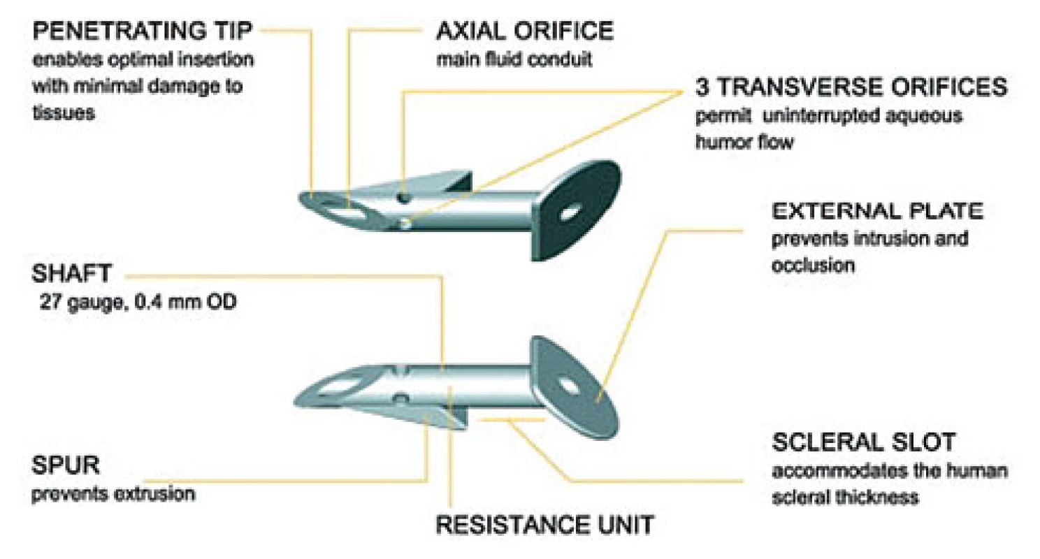 Description of the EX-PRESS implant (Source: Image provided by the manufacturer)
