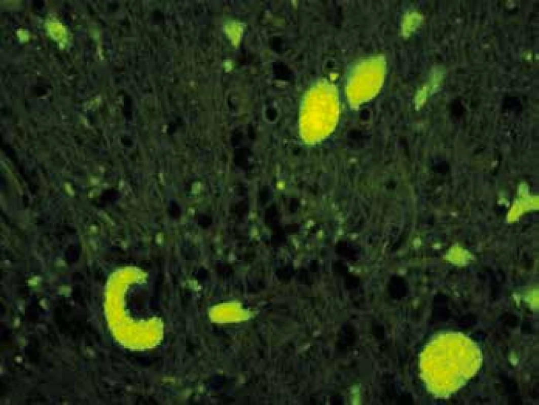 Autofluorescencia intracelulárneho pigmentu v Purkyňových
bunkách (zväčšenie 400x)