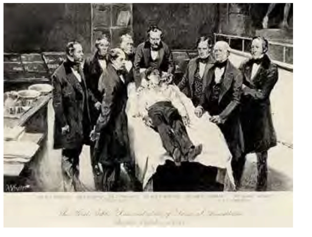 Prvá demonstrace éterové anestezie 16. 10. 1846. Zdroj: Wikimedia
Commons (CC BY 4.0)