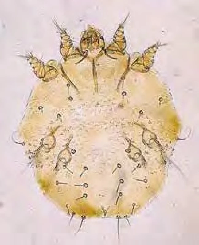 Sarcoptes scabiei (zákožka svrabová), roztoč.
[Foto: Alan R Walker; https://commons.wikimedia.org/
wiki/File:Sarcoptes-scabiei.JPG]