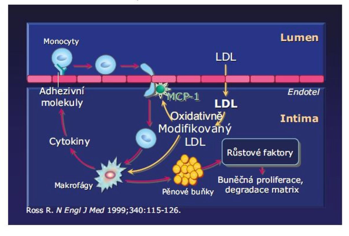 Proces aterosklerózy (LDL cholesterol)